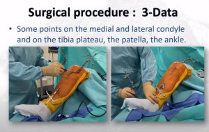 19è JLG - Procédure chirurgicale